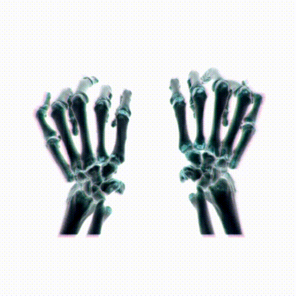 xradiare