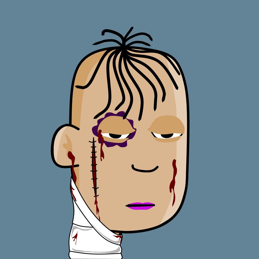 Injured Punk #60
