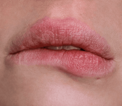 Lips - ROYseRsovS